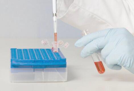 無(wú)創(chuàng)DNA鑒定怎么做